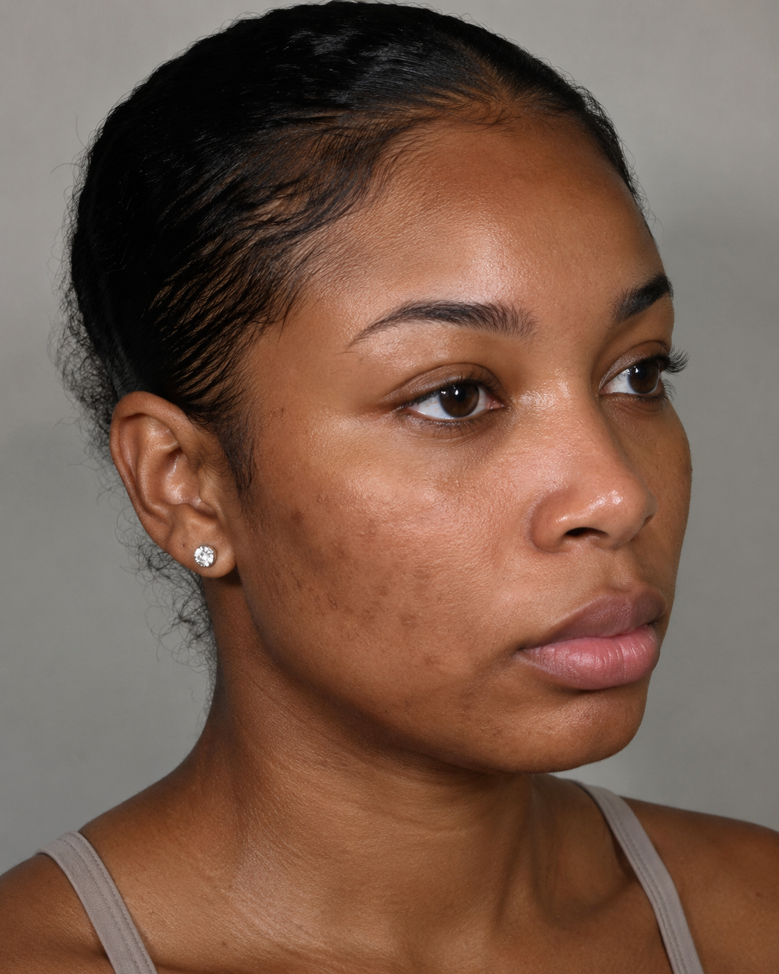Even skin tone before